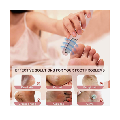 Electric Pedicure Foot File Callus Remover