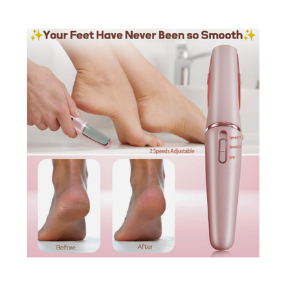 Electric Pedicure Foot File Callus Remover