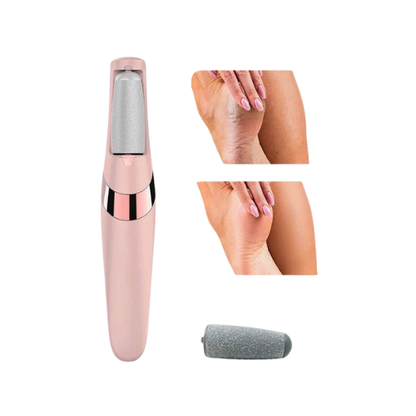 Electric Pedicure Foot File Callus Remover